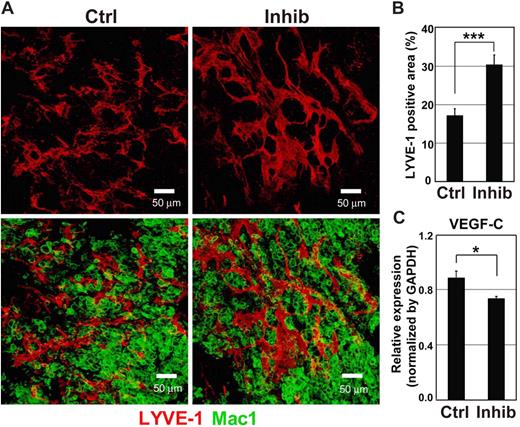 Figure 5. Enhancement of lymphangiogenesis by TβR-I inhibitor in a mouse model of chronic peritonitis. Mice were treated with 5% thioglycollate (2 mL) and TβR-I inhibitor (LY364947, 1 mg/kg) 3 times a week for 2 weeks. Their diaphragms were then examined for lymphangiogenesis in plaques. (A) LYVE-1 immunostaining (shown in red) of diaphragms treated without (control, left panels) or with TβR-I inhibitor (right panels). Sections were also stained for Mac1 (green) (bottom panels). Bars represent 50 μm. (B) Quantification of LYVE-1-positive area in plaques of the diaphragms treated without (control) or with TβR-I inhibitor (n = 3 for each group). Error bars represent SE (***P < .001). (C) Expression of VEGF-C in inflammatory macrophages in the presence and absence of TβR-I inhibitor. Inflammatory macrophages were harvested from ascites fluid of mice 4 days after induction of peritonitis by intraperitoneal injection of thioglycollate, seeded at 106, and treated with or without TβR-I inhibitor for 24 hours. Error bars represent SD (*P < .05).