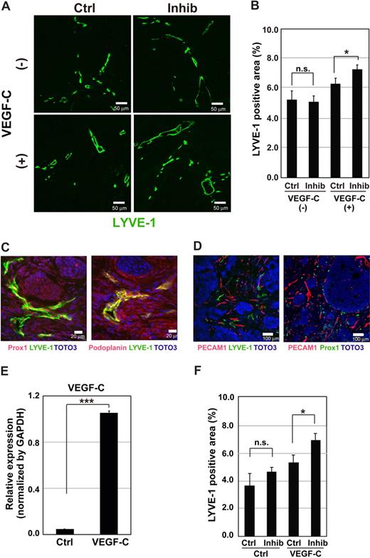 Figure 6. Lymphangiogenesis is increased by TβR-I inhibitor in pancreatic adenocarcinoma BxPC3 xenograft models. (A-D) Effects of TβR-I inhibitor on lymphangiogenesis were examined in a xenograft model using a human pancreatic cancer cell line, BxPC3. BxPC3 cells mixed with or without VEGF-C (1 μg/mL) were subcutaneously inoculated in BALB/c nude mice. After tumors had formed, the mice were injected intraperitoneally with TβR-I inhibitor (LY364947, 1 mg/kg) 3 times a week for 3 weeks. They were killed at the end of the experiment, and excised tumors were examined histologically. (A) Immunostaining of BxPC3 xenograft sections by LYVE-1 antibody (shown in green). Bars represent 50 μm. (B) LYVE-1–positive areas in the BxPC3 xenograft sections were determined in the presence and absence of VEGF-C and TβR-I inhibitor (n = 3 for each group). Error bars represent SE. n.s. indicates not significant (*P < .05). (C) Immunostaining of BxPC3 xenograft sections for Prox1 (left panel, red), podoplanin (right panel, red), and LYVE-1 (green). Bars represent 20 μm. (D) Immunostaining of BxPC3 xenograft sections for PECAM1 (red), LYVE-1 (left panel, green), Prox1 (right panel, green), and TOTO-3 (blue). Bars represent 100 μm. (E,F) Effects of TβR-I inhibitor on lymphangiogenesis were examined in a xenograft model using BxPC3 cells overexpressing VEGF-C by infection of the VEGF-C-lentivirus. BxPC3 cells infected with a lentivirus containing GFP were used as a control. (E) Up-regulation of VEGF-C mRNA in BxPC3 cells after infection of the VEGF-C-lentivirus was determined by real-time PCR. (F) LYVE-1-positive areas in the GFP- and VEGF-C–expressing BxPC3 xenograft sections treated with or without TβR-I inhibitor were determined (n = 3 for each group). Error bars represent SE. n.s. indicates not significant (***P < .001).