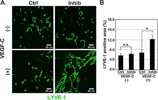 Figure 7. Induction of lymphangiogenesis by TβR-I inhibitor in MIA PaCa-2 xenograft models. (A,B) Effects of TβR-I inhibitor on lymphangiogenesis were examined in a xenograft model using a TGF-β–nonresponsive human pancreatic cancer cell line, MIA PaCa-2. MIA PaCa-2 cells mixed with or without VEGF-C (1 μg/mL) were subcutaneously inoculated in BALB/c nude mice and treated with TβR-I inhibitor (1 mg/kg) as described in Figure 7. Bars represent 50 μm. (A) Immunostaining of MIA PaCa-2 xenograft sections by LYVE-1 (shown in green). (B) LYVE-1–positive areas in the MIA PaCa-2 xenograft sections in the presence or absence of VEGF-C and TβR-I inhibitor were determined (n = 3 for each group). Error bars represent SE. n.s. indicates not significant (*P < .05).