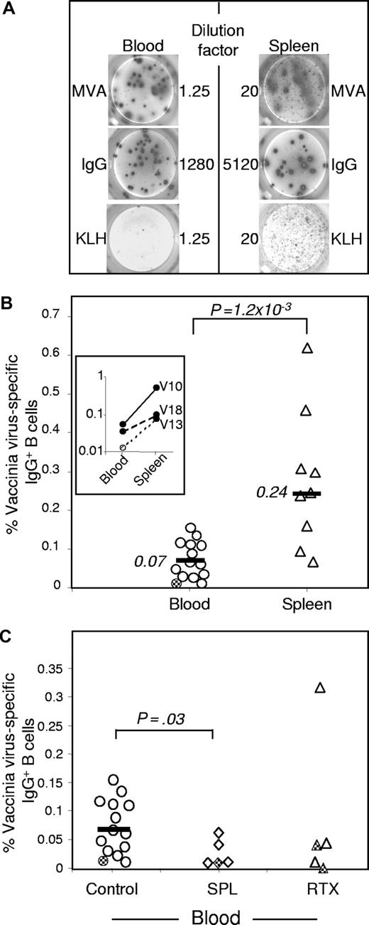 Figure 1. Vaccinia virus–specific memory B cells are enriched in the spleen and decreased in blood after splenectomy or rituximab treatment. ELISPOT assays were performed after 6 days of in vitro polyclonal stimulation of mononucleated cells. (A) ELISPOT showing a 10-fold enrichment of antivaccinia memory B cells in the spleen. MVA, anti-IgG, or an unrelated antigen (KLH) were used as coating antigens. Blood and spleen samples from patient V10 (Table 1). Shown is one representative ELISPOT well of 3, corresponding to the indicated dilution for each antigen. (B) Frequency of anti–vaccinia virus memory B cells in blood and spleen, determined by ELISPOT assay. The insert shows data from 3 patients (V10, V13, V18, Table 1) for whom both blood and spleen were analyzed. (C) Frequency of anti–vaccinia virus memory B cells determined by ELISPOT assay in blood of splenectomized (SPL) and rituximab-treated (RTX) patients, compared with healthy donors (control, same samples as in B). Bold lines indicate the median values for groups with sample size more than 5. Dashed symbols correspond to maximum estimates for individuals for whom specific memory B cells were undetectable (“Memory B-cell assay”). P values are determined by a nonparametric Kruskal-Wallis 2-sided test.
