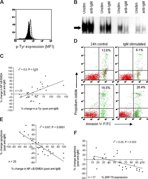 Figure 2. Analysis of proximal and distal signaling events in CLL cells derived from CLL patients. (A) CLL cells were left untreated (black histogram) or treated with anti-IgM (gray histogram) for 15 minutes. They were then fixed and stained with an FITC-conjugated antiphosphotyrosine antibody (PY20), and fluorescence was measured by flow cytometry. (B) CLL cells were left untreated or treated with anti-IgM as indicated for 1 hour. Nuclear extracts were prepared and NF-κB activity was evaluated by electrophoretic mobility shift assay; only the shifted bands are shown. (C) The percentage change in protein tyrosine phosphorylation and NF-κB activity (before and after ligation with anti-IgM) was calculated. The percentage change in NF-κB correlated with percentage change in protein tyrosine phosphorylation (r2 = 0.2, P = .03). (D) Cell apoptosis was measured after 24 hours using annexin V binding and PI exclusion in untreated CLL cells and cells treated with anti-IgM. The percentages shown in the upper right quadrant of each dot plot denote the total percentage of apoptotic cells in the upper and lower right quadrants. (E) The relationship between the percentage change in NF-κB and the percentage change in apoptosis was investigated, and a significant inverse correlation was detected (r2 = 0.67, P < .001). (F) ZAP-70 expression was associated with NF-κB activation after exposure to anti-IgM (P = .003).