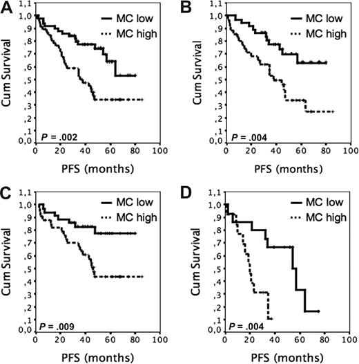 Figure 1. The outcome of R-CHOP–treated patients with FL according to tumor-infiltrating MC content. (A) PFS of 98 R-CHOP–treated patients according to high (> median 1.5; n = 47) and low (≤ 1.5; n = 51) Leder stain–positive MC content. (B) PFS of 73 R-CHOP–treated patients according to high (> 6.6; n = 35) and low (≤ 6.6; n = 38) tryptase-positive MC content. (C) PFS after front-line R-CHOP according to high (n = 34) and low (n = 36) Leder stain–positive MC content. (D) PFS of patients treated with immunochemotherapy at relapse according to high (n = 13) and low (n = 15) Leder stain–positive MC content.