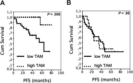 Figure 2. The outcome of R-CHOP–treated patients with FL according to tumor-infiltrating MCs and TAMs. (A) PFS of patients with low MC scores according to high (n = 17) and low (n = 34) TAM content. (B) PFS of patients with high MC scores according to high (n = 15) and low (n = 32) TAM content.