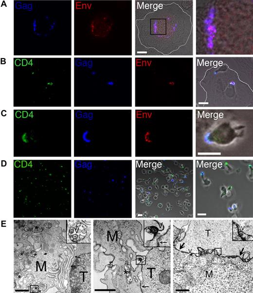 Figure 1. Macrophages transmit HIV-1 to CD4+ T cells across a virological synapse-like structure. Human MDMs were differentiated on glass coverslips for 7 days prior to infection with 6 ng CA-p24 of the HIV-1BaL isolate for a further 7 days. MDMs were subsequently cocultured with 5 × 105 PHA/IL-2–activated autologous CD4+ T cells that were prestained for CD4. Unattached T cells were carefully removed by aspiration at various times after coculture and incubated on poly-l-lysine–treated coverslips for 1 hour followed by fixation in 4% PFA. MDMs were gently washed with warm RPMI, and were fixed together with remaining attached T cells. Samples were subsequently permeabilized and stained for Gag and Env, and analyzed by LSCM. (A) HIV-1–infected MDMs in the absence of T cells. We used clone C49 to stain Gag-p17, which recognizes p17 cleaved from p55, representing mature virions. The right-hand panel is a magnified image of the boxed region from the merged image. A white line is drawn to indicate the MDM cell membrane in panels A and B. (B,C) MDM–T-cell cocultures stained for CD4, Gag, and Env. (D) Detached CD4+ T cells stained for HIV-1 Gag and CD4. White scale bars in panels A-D represent 10 μm. (E) EM analysis of the contact zone between HIV-1–infected MDMs and CD4+ T cells. Cells were cocultured for 5 hours in the presence of trace amounts of PHA (0.06 μg/mL) to stabilize clustered cells for sample preparation. M represents MDMs; T, CD4+ T cell; *, virus-containing vacuolar compartment; and V, HIV-1 particles; arrows point to closely apposed plasma membranes of MDMs and T cells. Note that many of the cell and viral membranes appear dense and strongly contrasted by the presence of ruthenium red label. Black scale bars represent 1 μm.