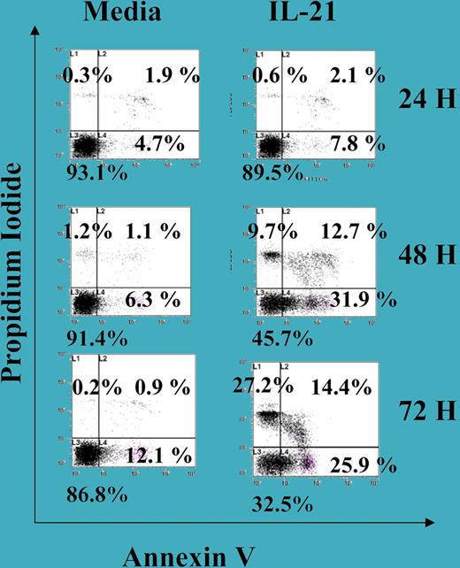 IL-21–induced cell death in B-CLL cells. See the complete figure in the article beginning on page 4723.