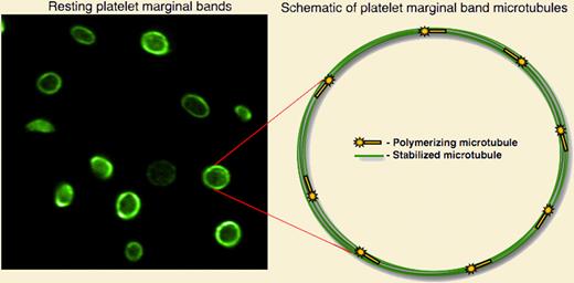 The discoid shape of resting blood platelets is maintained by a marginal band of microtubules, highlighted by staining with antitubulin antibody (left panel). Visualization of cytoskeletal dynamics in live, resting platelets reveals a dynamic marginal band with multiple actively polymerized microtubules.