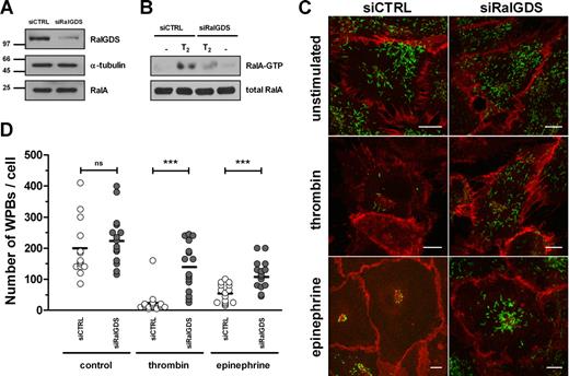 Figure 1. RalGDS knockdown by siRalGDS impairs stimulus-induced exocytosis of WPBs. (A) HUVECs were treated in 2 consecutive transfection rounds with a pool of 4 siRNA oligonucleotides directed against RalGDS (siRalGDS) or a control siRNA oligonucleotide (siCTRL). Western blot analysis 48 hours after transfection showed down-regulation of RalGDS expression, while α-tubulin and RalA remained unaffected. (B) Activation of RalA in siCTRL- and siRalGDS-treated HUVECs in response to thrombin was determined using a Ral-GTP specific pulldown. Cells were preincubated with SF medium for 1 hour, after which they were stimulated for 2 minutes with 1 U/mL thrombin (T2) or SF medium alone (−). All lysates contained similar amounts of RalA (bottom panel). (C) Representative confocal images of siCTRL- and siRalGDS-treated HUVECs that were incubated for 45 minutes with 1 U/mL thrombin, 10 μM epinephrine, and 100 μM IBMX or SF medium alone (unstimulated). WPBs were visualized by immunofluorescent staining of VWF (green), while staining of β-catenin (red) was used to delineate the cell membrane. Bars correspond to 10 μm. (D) Numbers of WPBs in individual cells were quantified as described in “CaM pull-down assays.” Approximately 15 randomly selected cells were counted for each experimental condition. Shown is the analysis of 1 experiment representative of 3 independent experiments. Horizontal bars represent medians. ***P < .001 by Student t test.