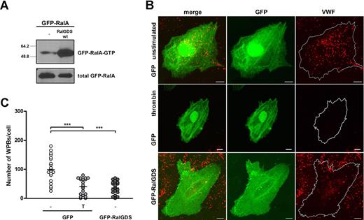 Figure 2. RalGDS induces RalA activation and WPB exocytosis. (A) Activation of GFP-RalA upon coexpression of GFP-RalGDS in HEK293 cells was determined using a Ral-GTP–specific pulldown. Total GFP-RalA levels are shown in the lower panel showing equal expression. (B) HUVECs were transfected with GFP (negative control) or GFP-RalGDS and grown for 48 hours. GFP-expressing cells were incubated with 1 U/mL thrombin (T) or SF medium alone (−) for 45 minutes. WPBs were visualized by immunofluorescent staining of VWF (red). Shown are representative confocal images of HUVECs expressing GFP or GFP-RalGDS. Bars correspond to 10 μm. (C) The numbers of WPBs in individual, randomly selected GFP- and GFP-RalGDS–positive cells were quantified using confocal microscopy. Horizontal bars represent medians. ***P < .001 by Student t test.