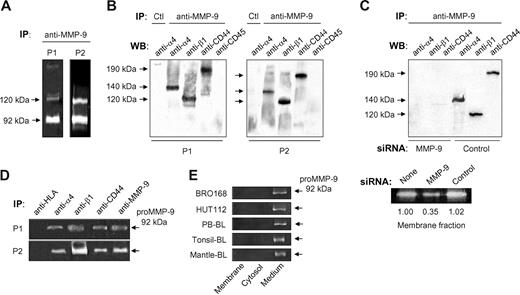 Figure 1. proMMP-9 interacts with α4β1 integrin and a high-molecular-weight CD44 isoform in B-CLL cells. Lysates from 2 × 107 B-CLL cells cultured for 24 hours in RPMI/0.1% FCS were immunoprecipitated with anti–MMP-9 pAbs or with rabbit IgG (Ctl), and analyzed by gelatin zymography (A) and Western blotting (B). The results from 2 patients of the 3 analyzed with identical results are shown. (C) Lysates from 2 × 107 B-CLL cells transfected with MMP-9 or control siRNA were immunoprecipitated with anti–MMP-9 pAbs and analyzed by Western blotting. The efficiency of the siRNA transfection was confirmed by gelatin zymography. (D) B-CLL cell lysates were immunoprecipitated with the indicated Abs and analyzed by gelatin zymography. Anti-HLA and anti–MMP-9 Abs were used as negative and positive controls, respectively. (E) Gelatin zymographic analysis of the cell fractions and conditioned media of the indicated B-cell types, after 24-hour cell culture.