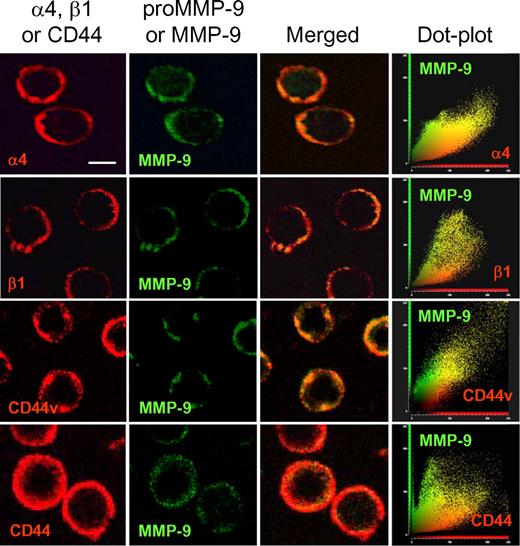Figure 6. Colocalization of MMP-9 with CD44v and α4β1 integrin in B-CLL cells. B-CLL cells from a representative sample were added to glass coverslips coated with 5 μg/mL poly-lysine. After 1 hour at 37°C, cells were fixed and analyzed by confocal microscopy using specific Abs for α4, β1, CD44v7,8, and CD44, followed by Texas-Red–labeled secondary Abs. MMP-9 was detected with specific pAbs and Alexa 488–labeled secondary Abs. Colocalization of MMP-9 with CD44v and α4β1 was further demonstrated using dot-plot analyses. Images were acquired using a confocal scanning inverted AOBS/SP2 microscope (Leica Microsystems, Heidelberg, Germany) with a 63×/1.3 NA PL-APO glycerol immersion objective. Leica's LCS 15.37 dye-separation software was used for colocalization studies; when necessary, Adobe Photoshop 7.0 (Adobe Systems, San Jose, CA) was used for image processing. Bar represents 4 μm.