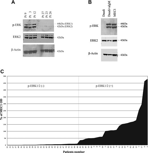 Figure 1. Phosphorylation of ERK in CLL cells. (A) Extracts from CLL cells purified from peripheral blood of 6 representative patients (of 51 tested) were analyzed for phosphorylation of ERK1/2 by Western blot with p-ERK1/2–specific antibody (top panel). Immunoblot was stripped and reblotted with ERK2-specific antibody (middle panel) or β-actin–specific antibody (bottom panel). (B) Extracts from unstimulated Daudi cells, anti-IgM–treated Daudi cells, and unstimulated MEC1 cells were analyzed by SDS-PAGE followed by immunoblot with p-ERK1/2 antibody (top panel), followed by stripping and reblotting of the immunoblots with ERK2-specific antibody (middle panel) or β-actin–specific antibody (botttom panel). (C) Densitometric analysis of p-ERK/ERK levels in CLL samples. The values of individual patients were calculated as percentage of the positive control (MEC1 cell line) and determined as the ratio of the OD of p-ERK and OD of total ERK.