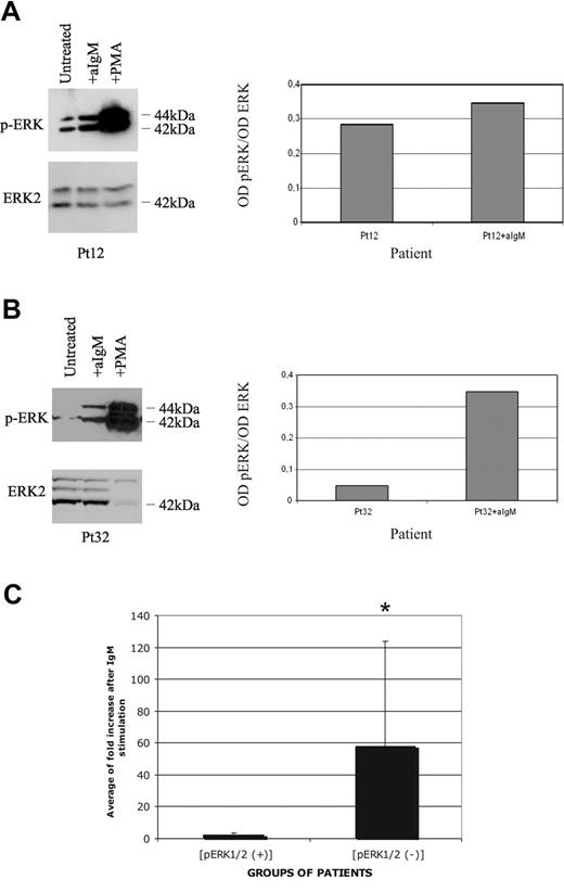 Figure 4. Attenuated BCR signaling in p-ERK–positive CLL cells. (A) One phospho-ERK–positive patient was either untreated, or stimulated with anti-IgM or PMA, and analyzed for ERK1/2 phosphorylation (top panels), or total ERK2 protein levels (bottom panels) by Western blot analysis. Densitometric analysis is reported in the right part of the panel. (B) CLL cells from one phospho-ERK–negative patient were either untreated, or stimulated with anti-IgM or PMA, and analyzed for ERK1/2 phosphorylation (top panels), or total ERK2 protein levels (bottom panels) by Western blot analysis. Densitometric analysis is reported in the right part of the panel. (C) Densitometric analysis of 5 p-ERK+ and 4 p-ERK− patients before and after anti-IgM treatment. Data are expressed as average of fold induction and SD. t test was performed between p-ERK+ and p-ERK− samples; *P < .05.