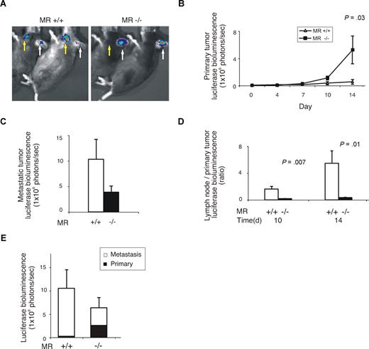 Figure 2. Lack of mannose receptor alters the behavior of B16 melanoma. (A) Representative examples of mice after subcutaneous injections of B16 melanoma cells bearing the luciferase-containing construct into the ears. Arrows point to the signals from the primary tumors (white) and metastatic foci (yellow) in the neck lymph nodes. (B) The size of the primary tumors during the 14-day follow-up measured based on the luciferase signals. (C) The size of the lymph node metastases at the end of the experiment. (D) The ratios between the lymph node metastases and primary tumors of WT and MR−/− mice. (E) Total luciferase counts of primary tumor and lymph node metastases in MR−/− and WT mice at the end of the experiments (14 days). All values shown are means (± SEM).