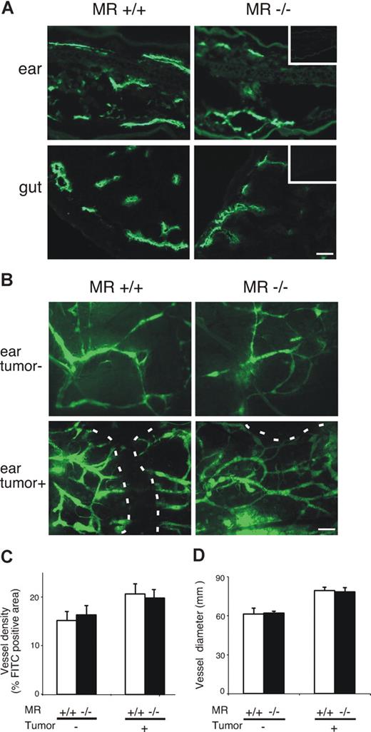 Figure 4. Lymphatics are anatomically and phenotypically normal in MR−/− mice. (A) Examples of expression of LYVE-1 in the ears and gut of normal MR−/− mice and their WT controls. Insets are negative control stainings with normal rabbit serum as the first-stage antibody. Bar represents 50 μm. (B) FITC-dextran was used to visualize lymphatics in the ears of healthy and tumor-bearing MR−/− and WT mice. Lymphatics are almost exclusively peritumoral in the tumor-bearing ears. A dashed line outlines the tumor. Bar represents 100 μm. Objectives: Olympus UPlanFl 10×/0.30 Ph 1 for panel A and 4×/0.13 for panel B. (C) Density and (D) diameter of lymphatics in MR and WT mice without and with tumors. Values shown are means (± SEM).