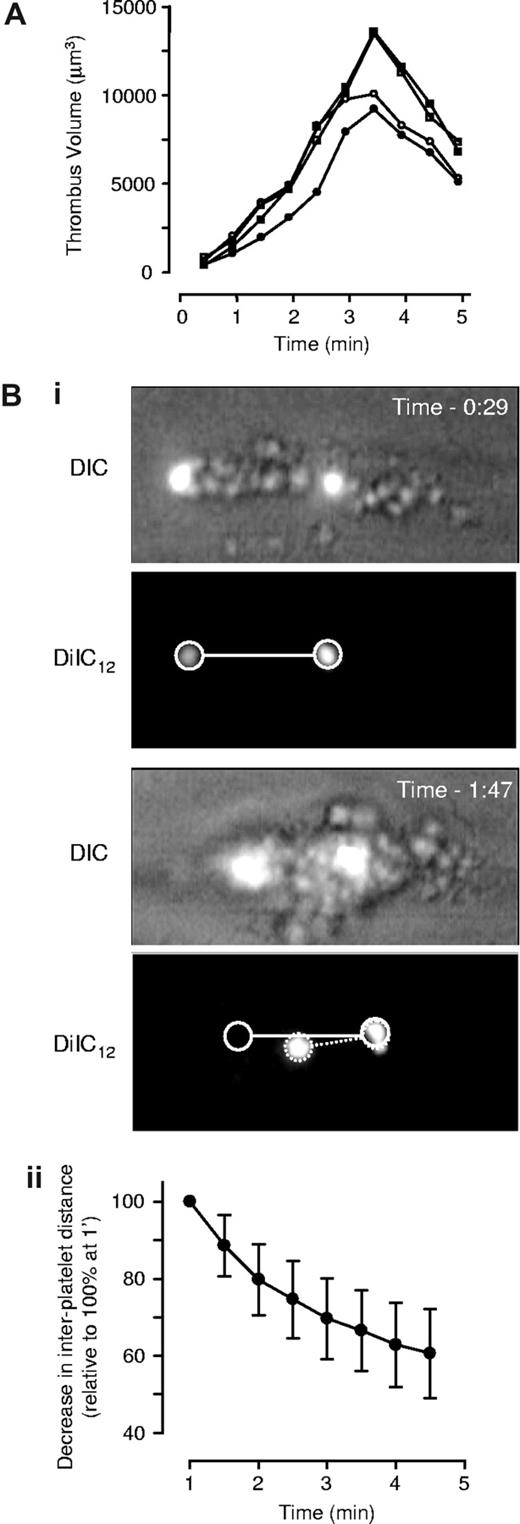 Figure 2. Characterization of thrombus consolidation in vitro. Lepirudin-anticoagulated human whole-blood was perfused through collagen-coated microslides at 1800 s−1. (A) To quantify thrombus volume, whole blood was preincubated with DiIC12 prior to perfusion, and three-dimensional images captured in real-time using an inverted Leica DMIRB confocal microscope, followed by off-line analysis to quantify thrombus volume, as described in “Three-dimensional volumetric thrombus analysis.” This graph depicts thrombus volume over time from 4 individual thrombi taken from 4 independent experiments. (B) Quantification of thrombus consolidation was performed by “spiking” whole blood with DiIC12-labeled platelets prior to perfusion, followed by capture of consecutive DIC and fluorescence images in real-time. (i) Images are taken from 1 flow representative of 12 independent flows. (ii) The decrease in distance between firmly adherent platelets was quantified as described in “Two-dimensional quantification of thrombus consolidation” and used as an indirect marker of thrombus contraction. Results are expressed as the mean plus or minus SD of 36 individual thrombi, from 12 independent experiments (n = 12; —).