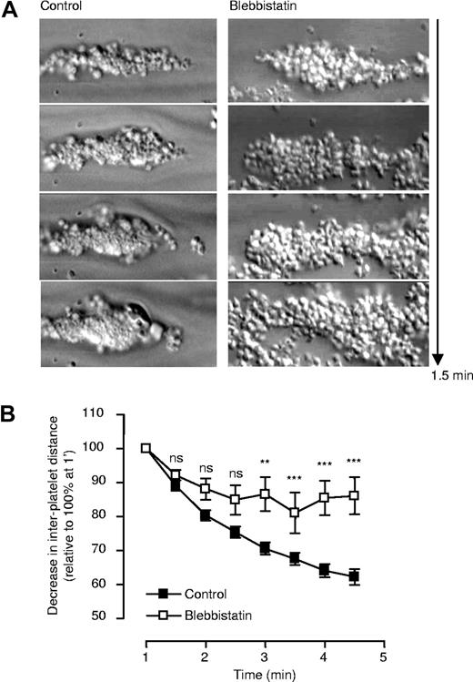 Figure 5. Effect of the myosin II inhibitor (blebbistatin) on thrombus consolidation in vitro. Lepirudin-anticoagulated human whole blood was preincubated with blebbistatin, or an inactive enantiomer of blebbistatin (control), prior to perfusion through collagen-coated microslides at 1800 s−1, as described in “Two-dimensional quantification of thrombus consolidation.” (A) Snapshots of individual thrombi over a time period of 1.5 minutes were obtained off-line. These images are taken from 1 representative of 3 independent experiments. (B) Whole blood spiked with DiIC12-labeled platelets was perfused through collagen-coated microslides at 1800 s−1, and the distance between firmly adherent platelets quantified, as described in “Two-dimensional quantification of thrombus consolidation.” Results represent the mean plus or minus SEM (n = 3; ns P > .05; **P < .005; ***P < .001).