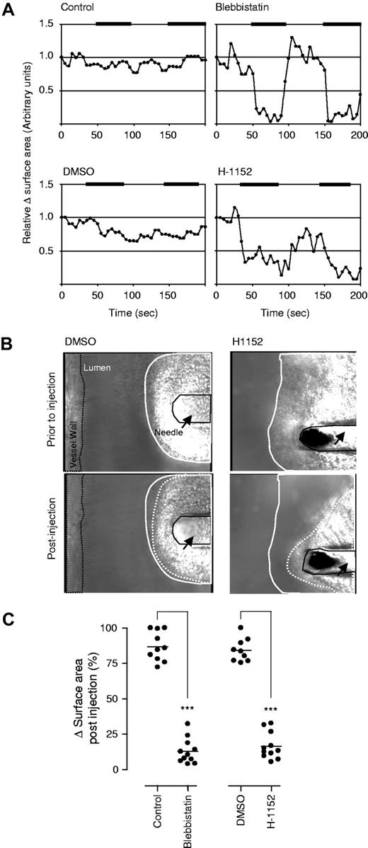 Figure 7. Role of myosin IIA and Rho kinase in regulating the stability of the primary hemostatic plug. Vascular injury was induced in the mesenteric postcapillary venules of anesthetized C57/Bl6 mice by needle puncture, in the presence of lepirudin (50 mg/kg, administered intravenously prior to injury). In the indicated experiments, the effects of blebbistatin, an inactive enantiomer of blebbistatin (control), vehicle (DMSO), or H1152 on thrombus stability was assessed following repetitive injections (denoted by ▀), with concentrations and volumes as described in “Intravital microscopy.” (A) The relative change in surface area of a given thrombus over time was determined off-line, and expressed relative to the initial surface area of the thrombus prior to injection. These results depict data taken from 1 of 4 independent experiments, with representative images from one such experiment depicted in panel B. (C) The percentage decrease in thrombus size following each infusion of vehicle/inhibitor was quantified as described in “Intravital microscopy,” and expressed as a percentage (%) of the original thrombus prior to infusion. These results represent the mean plus or minus SEM (n = 4), where *** indicates P < .001.