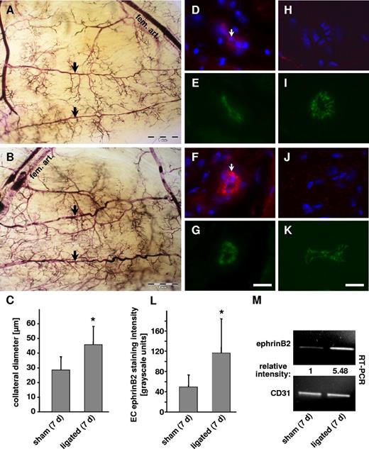 Figure 3. Morphologic analysis of collateral arteries in transparent mouse hindlimbs. Arteries were visualized by pigment perfusion in sham-operated (A) and ligated (B) hindlimbs. Diameter of collateral arterioles (A,B, ) was significantly increased (C, *P < .05 vs sham, n = 5) 7 days after ligation of the femoral artery. Immunofluorescence staining of ephrinB2 (Cy3) in collateral arterioles (D,F) was quantified by morphometry (L). In contrast to control conditions (D,L; *P < .05 vs sham, n = 4), endothelial cell ephrinB2 staining intensity (arrow) was significantly increased if the collateral arterioles underwent arteriogenic remodeling (F, arrow). CD31 immunofluorescence (Cy2) was used as a control to validate integrity of the endothelial cell monolayer (E,G; scale bars represent 10 μm). A species-matched control antibody did not produce any detectable immunostaining in collaterals from sham-operated (H, control antibody: red fluorescence; I, CD31: green fluorescence) or from ligated hindlimbs (J, control antibody; K, CD31; scale bars represent 10 μm). Individual collateral arterioles were isolated and subjected to RT-PCR analysis, which confirmed the increased expression of ephrinB2 in collateral arterioles undergoing arteriogenic remodeling (M, RT-PCR analysis of CD31 was used as an endothelial cell–specific internal standard).