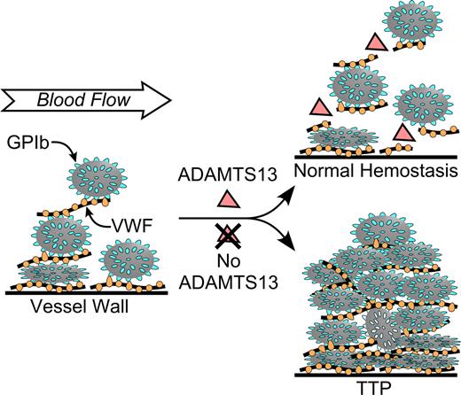 Figure 2. Pathogenesis of idiopathic TTP caused by ADAMTS13 deficiency. Multimeric VWF adheres to endothelial cells or to connective tissue exposed in the vessel wall. Platelets adhere to VWF through platelet membrane GPIb. In flowing blood, VWF in the platelet-rich thrombus is stretched and cleaved by ADAMTS13, limiting thrombus growth. If ADAMTS13 is absent, VWF-dependent platelet accumulation continues, eventually causing microvascular thrombosis and TTP.