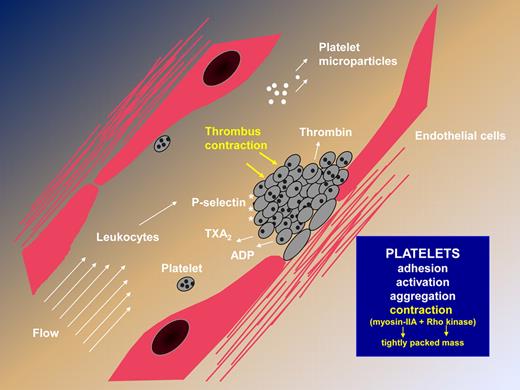 Steps leading to thrombus formation, highlighting the newly described contractile activity that results in a rapidly formed, tightly packed platelet mass independently of fibrin formation.