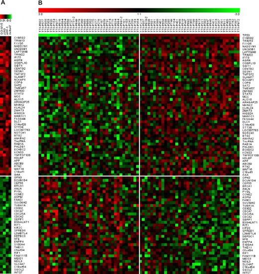 Figure 3. Gene expression profile of 85 TP53-regulated genes in MM cell lines and patients. A total of 85 genes were up-regulated (n = 50) or down-regulated (n = 35) at least 1.5-fold in at least 3 of 4 MM cell lines and also exhibited differential expression in a comparison of primary MM between the lowest relative to the highest TP53 expressers. (A) In the normalized log ratio (TP53 overexpression vs empty vector) of the 4 MM cell lines (JJN3, OCI-MY5, ARP-1, and Delta 47), red represents induction and green represents repression. (B) Differences in gene expression between 36 patients on TT2 with lowest TP53 expression and 36 patients with the highest TP53 expression.