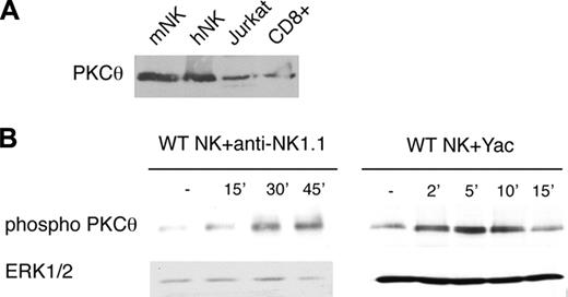 Figure 1. Cross-linking NK cell–activating receptors induces PKC-θ activation. (A) Equal amounts of protein from purified murine and human NK-cell lysates were loaded and then immunoblotted with anti–PKC-θ antibody. Lysates from Jurkat and CD8+ T cells were used as positive controls. (B) PKC-θ−/− and WT NK cells were expanded in IL-2 and then stimulated with plate-bound anti-NK1.1 (left panel) or conjugated with fixed YAC-1 cells (right panel). Cells were lysed and analyzed by immunoblotting with anti–phospho-PKC-θ and anti–total ERK1/2 antibodies. One experiment of 3 is represented.
