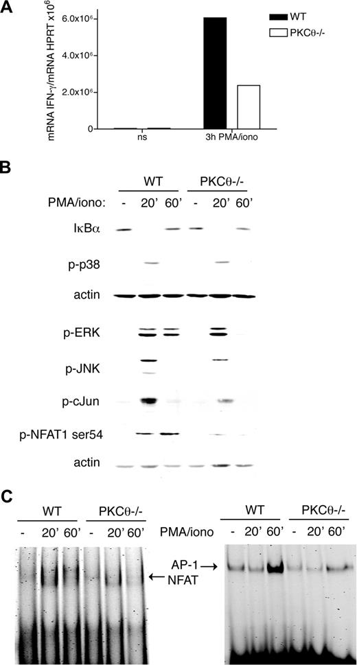 Figure 5. PKC-θ is required for NFAT and AP-1 activation. (A) IL-2–cultured PKC-θ−/− and WT NK cells were stimulated with PMA (50 ng/mL) and ionomycin (0.5 μg/mL), and transcription of IFN-γ was analyzed by RT-PCR. (B) IL-2–cultured PKC-θ−/− and WT NK cells were stimulated with PMA (50 ng/mL) and ionomycin (0.5 μg/mL). Cells were lysed and then analyzed by immunoblotting with anti-IκBα, anti–phospho-p38, ERK, JNK, c-Fos, and NFAT1-Ser54. As a loading control, membranes were probed with anti-actin antibody. (C) IL-2–cultured PKC-θ−/− and WT NK cells were stimulated as in panel B, and then nuclear extracts were analyzed by EMSA using probes containing NFAT or AP-1 binding sites. Results are representative of 3 independent experiments.
