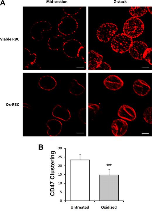 Figure 2. Reduced mobility of CD47 in the plasma membrane of Ox-RBCs. Untreated (viable RBCs) or Cu/ascorbate-treated (Ox-RBCs) RBCs were incubated sequentially with the anti-CD47 mAb miap430 and Cy3-conjugated goat anti–mouse IgG, followed by fixation in 3% paraformaldehyde and 0.01% glutaraldehyde. (A) RBCs adherent to poly-l-lysine–coated coverslips were analyzed by laser-scanning confocal microscopy. Z-stacks were obtained by scanning focal sections 0.5 μm apart throughout the cells. Scale bar represents 2 μm. Images are representative of 3 independent experiments. (B) The number of visible CD47 clusters was quantified in midsections of untreated RBCs or Ox-RBCs. Data are mean plus or minus SEM for 3 experiments with 50 RBCs analyzed in each experiment. **P < .01, using Student t test for paired comparisons.