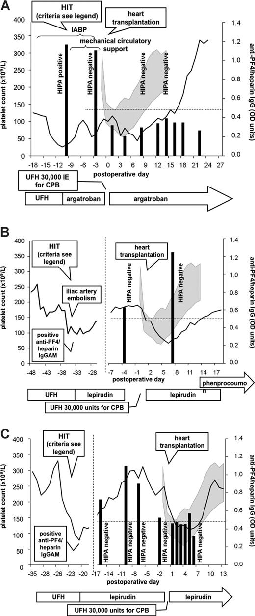 Figure 1. Three patients scheduled for heart transplantation with end-stage heart failure complicated by subacute heparin-induced thrombocytopenia (HIT). In all 3 patients, heart transplantation was successfully performed using short-term unfractionated heparin (UFH) during transplantation despite a positive anti-PF4/heparin IgG by enzyme-immunoassay (EIA). Results of the EIA test are represented by black vertical bars; results of the heparin-induced platelet-activating (HIPA) test are given as text; platelet count courses are represented by lines. The gray shaded area represents standard deviation (plus or minus) of mean platelet counts of 10 consecutive non-HIT patients after heart transplantation. The clinical course and laboratory test results (obtained from another hospital in patients 2 and 3) are given at the left hand side of the figure. Criteria to diagnose HIT in patient 1 were platelet decrease greater than 50% after 9 days of heparin treatment, positive anti-PF4/heparin IgG, positive HIPA, and rapid increase of platelet count after switching from heparin to argatroban. Criteria to diagnose HIT in patient 2 were platelet decrease greater than 50% after 7 days of heparin treatment, complicated by iliac artery embolism, positive anti-PF4/heparin IgGAM by a commercial EIA, and rapid increase of platelet count after switching from heparin to lepirudin. Criteria to diagnose HIT in patient 3 were platelet decrease greater than 50% after 7 days of heparin treatment, positive anti-PF4/heparin IgGAM by a commercial EIA, and rapid increase of platelet count after switching from heparin to lepirudin. CPB indicates cardiopulmonary bypass; IABP, intraaortic balloon pump; and OD, optical density.