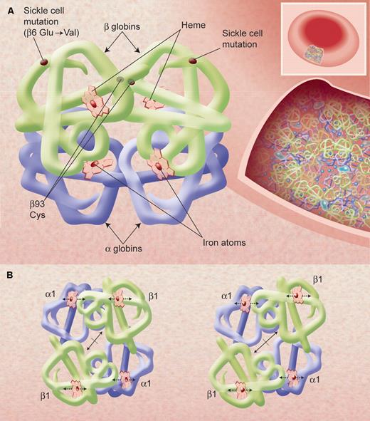 Figure 1. The X-ray determined structure of the hemoglobin molecule and a representation of its very high concentration in the erythrocyte. (A) The arrangement of the α-helices (shown as tubes) in each αβ unit—one on the left and one, 180° rotated, on the right—is shown, as are the 4 heme groups with their iron atoms where gas molecules bind. The site of the sickle mutations on mutant β-chains as well as the β93 conserved cysteine residues is also shown. Hemoglobin molecules in the red blood cell, shown in an inset on the right, are very tightly packed (at a concentration of approximately 34 g/dL) and have little access to solvent; this allows efficient oxygen transport by each cell but also affects the chemical behavior of the molecules, such as promoting sickle cell hemoglobin polymerization upon slight deoxygenation. (B) A representation of the quaternary structural changes in the hemoglobin tetramer, in a top-down view, in the transition from the oxy conformation (left) to the deoxy conformation (right). The iron atoms shift relative to the planes of the heme groups and a central cavity between the β-chains opens, facilitating 2,3 BPG binding. These diagrams are based on drawings of Irving M. Geis. Illustration by Alice Y. Chen.