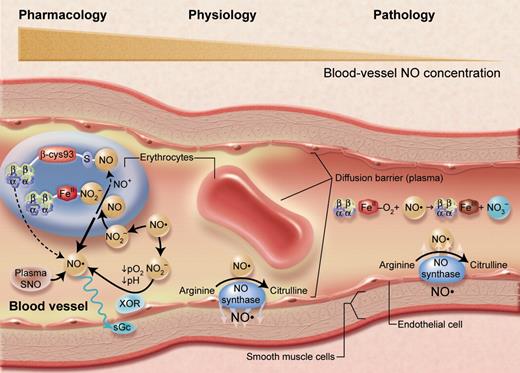 Figure 4. A representation of nitric oxide (NO)/hemoglobin reactions in the arterial microcirculation. Reactions that appear to predominate under physiologic conditions (center), as well as pathologic lesions due to hemolysis (right) and results of high or pharmacologic levels of NO (left) are indicated. Under basal conditions, NO (a short-lived free radical) produced by endothelial NO synthase enzymes largely diffuses into surrounding smooth muscle to activate soluble guanylyl cyclase (sGC) to produce cyclic GMP and regulate vascular tone. The interactions of NO with red cells under these conditions seem to be limited by several barriers to diffusion, at the red cell membrane and streaming of plasma near the endothelium. With hemolysis (or with administration of hemoglobin-based blood substitutes), cell-free oxyhemoglobin acts as an efficient scavenger of NO, causing vasoconstriction and perhaps pathological organ conditions. When endogenous NO levels become very high, or when it is administered by inhalation or by infusion of nitrite ions or other NO donors, reactions in the plasma and within erythrocytes become very important. Reactions with oxygen will tend to oxidize NO to nitrite and nitrate. Reactions with plasma molecules will form thiol (SNO) compounds and other species; plasma nitrite can also be reduced by endothelial xanthine oxidoreductase (XOR) to NO. Small amounts of SNO-Hb form, but its function is not at all clear. Nitrite from the plasma may enter the red cell or be formed in the cell itself, where reactions with hemoglobin and the ascorbate cycle can reduce it to NO. Although the prevalent reactions with oxyhemoglobin to form methemoglobin and nitrate tend to destroy NO bioactivity, these other reactions may allow its preservation and modulation for physiologic functions. Adapted from Schechter and Gladwin (N Engl J Med. 2003;348:1483-1485), with permission. Illustration by Alice Y. Chen.