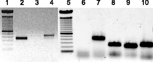 Figure 3. Analysis of RRV gene expression in lymphoma of animal 19185. RNA isolated from lymphoma of animal 19185 was analyzed by reverse transcriptase (RT)-PCR to confirm expression of vIL-6 and vFLIP and to analyze expression of ORFs 72 and 73. Lanes 1 and 5 indicate 100 base pair ladder; lane 2, RNA from lymphoma amplified with vIL-6-specific primers; lane 3, same as lane 2, minus RT; lanes 4 and 7, GADPH-specific primers as control for RNA; lane 6, no template control; lane 8, ORF-73–specific primers; lane 9, ORF-72–specific primers; and lane 10, ORF-71–specific primers.