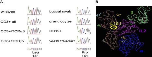 Figure 1. Genetic analysis. (A) DNA sequence analysis in PBMCs from a healthy control (wild type) and various cell populations from the patient obtained either by buccal swab, Ficoll separation (granulocytes), or flow cytometric cell sorting. The wild-type (left) and mutated nucleotide (right) sequences and the resulting amino acid change are shown below. (B) Location of the changed amino acid in a model of the IL-2 receptor with its bound ligand as calculated with the SWISS-MODEL software (The Swiss Institute of Bioinformatics). Brown indicates γ chain; green, β chain; blue, α chain; and purple, IL-2.