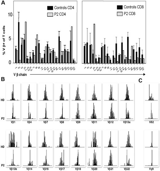 Figure 3. T-cell repertoire analysis. (A) Percentage of CD4+ and CD8+ T cells expressing the indicated TCR Vβ chains from the patient (▩) and median and range from healthy controls as determined by flow cytometry.25 (B) CDR3 length profile of the indicated Vβ populations from the patient (P2) and a 6-month-old healthy donor (HD). cDNA was prepared from PBMC RNA and amplified using Vβ–specific primers, and the size distribution of PCR products was determined by an automated sequencer and GeneMapper software version 4.0. The relative fluorescence intensity of the bands is shown as a function of the PCR fragment size. (C) CDR3 length profile of γδ T cells using Vδ2- and Vγ9-specific primers.