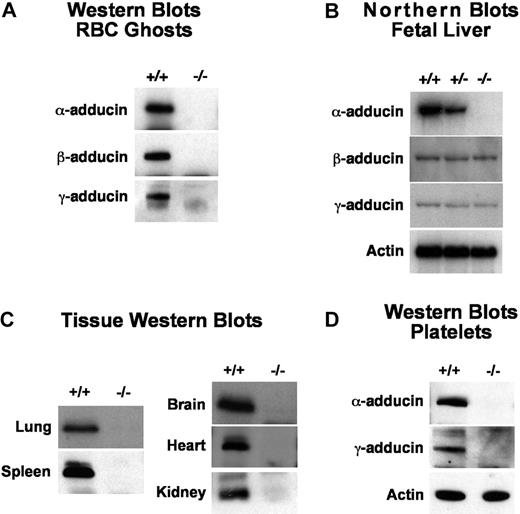Figure 2. Detection of gene products. (A) Western blots of RBC ghost proteins demonstrating loss of both β- and γ-adducin in α-adducin knockout mice. (B) Northern blots of E14.5 fetal livers showing loss of α-adducin mRNA but normal levels of β- and γ-adducin mRNA. The exon 10 to 12 α-adducin probe was used (Table 1). (C) Western blots demonstrating loss of α-adducin in all tissues examined. (D) Western blots demonstrating loss of platelet γ-adducin in α-adducin–null mice. +/+ indicates wild-type; +/−, heterozygotes; and −/−, homozygous null.