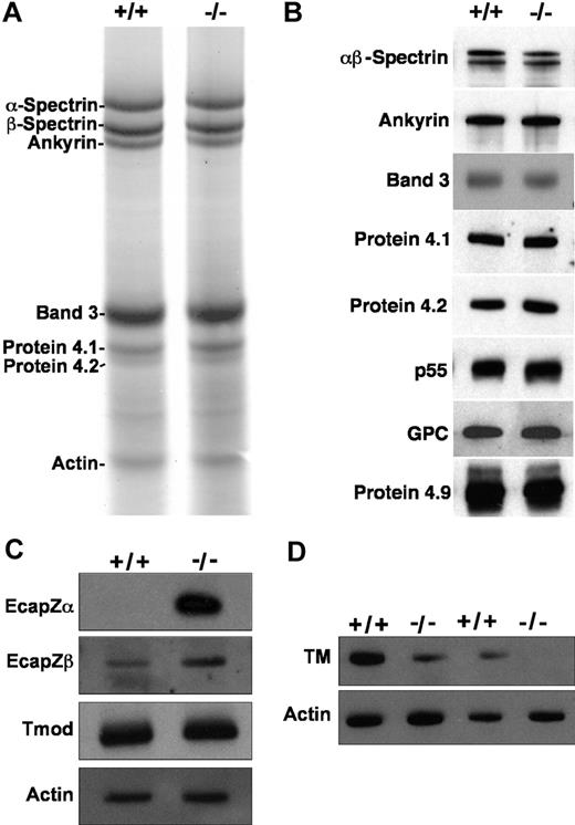 Figure 3. Membrane skeleton in α-adducin–null RBCs. The major membrane skeleton components α- and β-spectrin, ankyrin, band 3, proteins 4.1 and 4.2, and actin appear normal in α-adducin–null RBC ghost membranes by SDS-PAGE (A) and Western blotting (B). Other components of the junctional complex—p55, GPC, and protein 4.9 (dematin)—also appear normal. (C) The actin capping protein EcapZ is strikingly up-regulated in adducin-null RBC membranes. Tropomodulin (Tmod) appears normal. (D) TM is decreased to approximately 20% of normal in the absence of adducin. +/+ indicates wild-type; −/−, homozygous null.