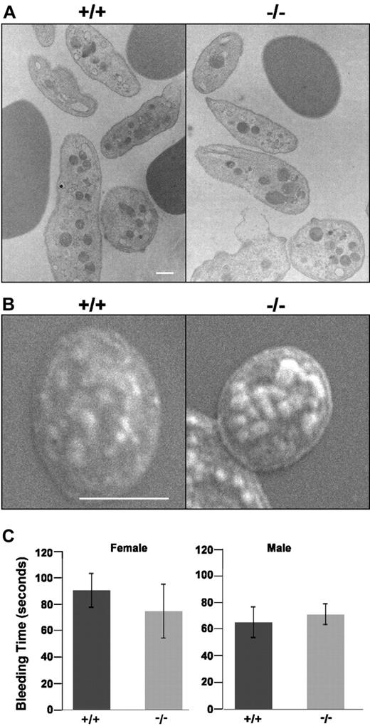 Figure 6. Platelet structure and function. TEM (A) and SEM (B) reveal adducin-null platelets maintain their normal discoid state in the circulation. (C) Bleeding times. X plus or minus SE.