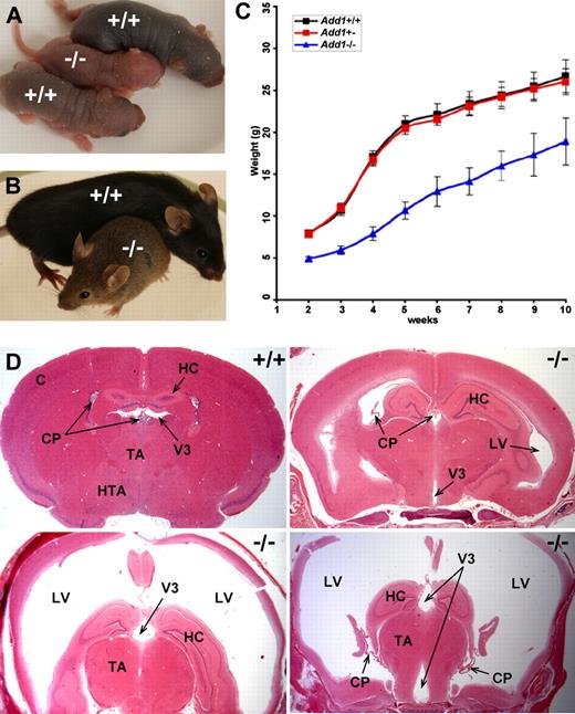 Figure 7. Growth retardation and lethal hydrocephalus in α-adducin–null mice. (A-C) α-Adducin–null mice are smaller at birth and throughout life compared with their normal littermates. Blue in panel C indicates X plus or minus SE. (D) Approximately 50% of α-adducin–null mice develop hydrocephalus with extreme dilation of the lateral and third ventricles. The fourth ventricle is also enlarged and the cerebral aqueduct is open (not shown), indicating communicating hydrocephalus. Significant thinning of the cortex is apparent as hydrocephalus worsens. Hydrocephalus was not observed in wild-type or heterozygous mice. C indicates cerebral cortex; CP, choroid plexus; HC, hippocampus; TA, thalamus; HTA, hypothalamus; LV, lateral ventricle; V3, third ventricle; +/+, wild-type; and −/−, homozygous null.