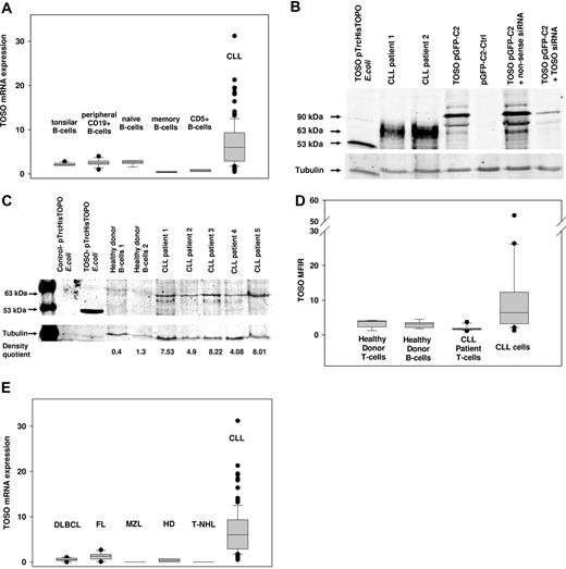 Figure 1. TOSO mRNA and protein expression detected by RT-PCR, immunoblotting, and flow cytometry. (A) TOSO mRNA expression in CD19+ peripheral B cells (n = 10), naive B peripheral B cells (n = 5), memory B cells (n = 3), and CD5+ B cells (n = 5) compared with purified CLL cells (n = 106). (B) TOSO is detected at 63 kDa due to posttranslational modification. Western blot using TOSO-specific 6B10 monoclonal antibody is shown for TOSO-pTRCHisTOPO recombinantly expressed in E coli, for patient CLL cells, and for TOSO-pGFP-C2 being transduced to HEK293 cells; cotransfection of TOSO-pGFP-C2 with TOSO-specific siRNA was performed for control of 6B10 antibody specificity. (C) TOSO protein expression is elevated in CLL cells compared with healthy donor CD19+ B cells; immunoblotting was performed using 6B10 monoclonal antibody; nontransformed TOP10 E coli served as negative control, and recombinantly expressed TOSO-pTRCHisTOPO served as positive control. Densitometry quotient of TOSO/tubulin is indicated accordingly. (D) Flow cytometry assessment of TOSO surface expression comparing healthy donor T and B cells to CLL patient T cells and malignant CLL B cells. (E) TOSO mRNA expression compared with other lymphoma entities: diffuse large B-cell lymphoma (DLBCL, n = 6), follicular lymphoma (FL, n = 6), marginal zone lymphoma (MZL, n = 2), T-cell non-Hodgkin lymphoma (T-NHL, n = 2), and Hodgkin lymphoma–derived cell lines (n = 4). Panel A, D, and E box plots show median, lst and 3rd quartiles, and whiskers (error bars) defined by, at most, 1.5× interquartile range (IQR).