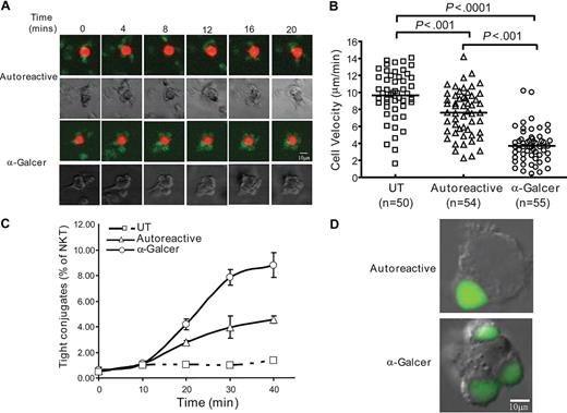Figure 3. Dynamics of autoreactive NKT cell interactions with APCs. (A) Time-lapse microscopy of NKT cells interacting with human myeloid DCs. Top rows show fluorescence images taken at the indicated times with NKT cells labeled green and the DCs labeled red, and the bottom rows show phase-contrast views. Data are from 1 representative experiment of 3. Videos S1 through S7 provide kinetic views of NKT cell-APC interactions. (B) Analysis of the velocity of NKT cells in the presence of the indicated APCs. Single-cell tracking analysis was performed using Image J software (NIH), and the average velocity of each T cell was calculated by dividing the distance traveled by the time (20 minutes). Horizontal bars within the datasets show the means with the P values calculated by ANOVA shown at the top. The results are from a representative experiment using clone JC2.4, and similar results were obtained with 1 additional clone. (C) Flow cytometric analysis of tight adherence of NKT cells to APCs. Fluorescently labeled NKT cells and APCs were coincubated for the indicated times, and tightly adhered conjugates were analyzed by flow cytometry. Data are mean plus or minus SD of 3 replicate samples and are from 1 representative experiment of 3 using clone J3N.5. Similar results were observed using 2 other NKT cell clones. (D) Microscopic analysis of carboxyfluorescein diacetate succinimidyl ester-labeled NKT cells (green) conjugated to APCs.