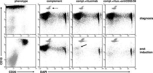 Figure 2. CD20 up-regulation in follow-up translates into efficient rituximab-induced complement-lysis. Dot plots are derived from analyses of paired BM samples of a high-risk BCP-ALL patient at diagnosis and at end-induction. Phenotypic comparisons and cell recovery analyses after in vitro incubations with complement alone, with complement plus rituximab (0.2 mg/mL), and with complement plus rituximab plus micro-antibodies neutralizing CD55 and CD59, are shown. The dashed arrow points at the cluster of Trucount beads that were used as internal standards for absolute cell recovery assessment. Up-regulation of CD20 expression can be seen on the CD10+ leukemic cells (black), which remained after therapy. An almost complete reduction of intact (4′6-diamidino-2-phenylindole, dihydrochloride-negative) CD10+ leukemic cells can be seen on rituximab incubations, with a small remnant fraction of viable leukemic cells marked with an arrow. Of note, cells lysed by complement mostly disappear from dot plots on severe cellular disruption.