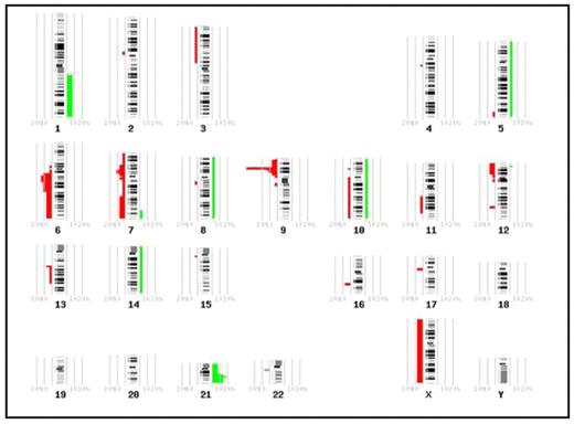 Figure 1. DNA copy number alterations detected with array CGH in 27 adolescent ALL patients with initially normal or failed karyotype. Vertical lines to the left and right of each chromosome represents copy number losses and gains, respectively.