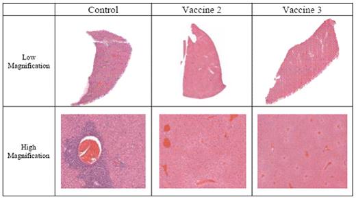 Figure 1:. Hematoxylin and Eosin staining of liver sections taken from control and vaccinated mice inoculated with RAW117-H10 lymphoma.