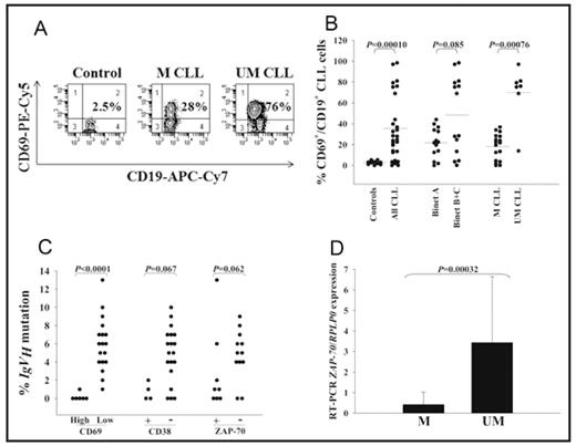 Figure 1. A) Flow cytometry of CD69 in CD19+ cells in one representative control, mutated and unmutated CLL patient, respectively. B) CD19+ B cells from 10 controls and 28 patients were analyzed for CD69 expression. % CD69+/CD19+ cells in controls vs. all CLL patients, Binet A vs. Binet B+C and mutated vs. unmutated CLL patient. Horizontal lines represent mean values in each group. C) Concordance between IgVH mutation status and CD69, CD38 and ZAP-70. Individuals with ≥ 20% positive CD19+ cells were defined as positive for CD38 and ZAP-70. For CD69, individuals with ≥ 50% positive CD19+ cells were defined as “high CD69” and individuals with <50% CD69 were defined as “low CD69”. Percentage deviation from the most similar germline gene is shown. Genes with ≥ 2% deviation (dotted line) were defined as mutated. D) ZAP-70 mRNA expression was analyzed in 22 patients by RT-PCR. Mean ZAP-70/RPLP0 expression±SD in CLL patients with mutated IgVH genes (n=16) vs. unmutated IgVH genes (n=6) are shown.