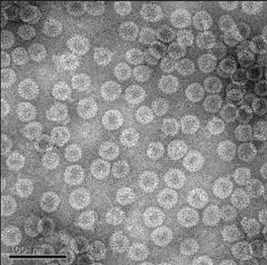 Figure 1. Electronmicrographs of recombinant HTLV-1 Tax/HBc chimeric particles.