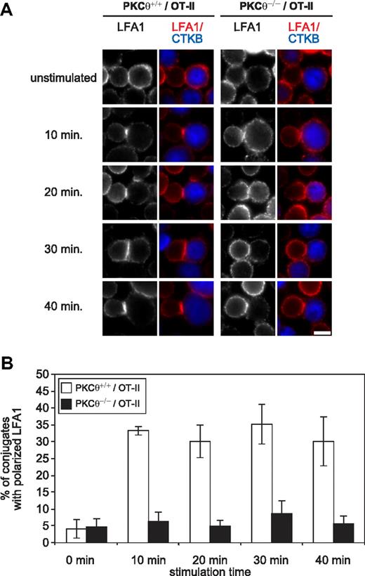 Figure 7. PKC-θ promotes T cell LFA-1/ICAM-1 binding during antigen recognition. (A) Fluorescence microscopy images of OT-II/PKC-θ+/+ and OT-II/PKC-θ−/− CD4+ T cell/B cell conjugates.66,67 OT-II CD4+ T cells were added to LPS-activated B cells (blue) pulsed overnight with or without (unstimulated control) 2 μM of OVA323-339 and incubated at 37°C for 10, 20, 30, and 40 minutes. After fixation, the conjugates were stained for LFA-1 (red). Bar scale represents 5 μm. (B) Graph represents the percentages of conjugates with polarized LFA-1 staining. These results correspond to the data obtained with 2 independent experiments where at least 40 conjugates in each of 5 micrographic fields were counted. Interaction of genotype and stimulation: F(4,10) = 4324; P = .028; factorial ANOVA (SPSS).