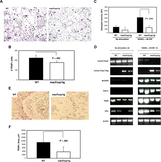 Figure 7. Osteoclastogenesis and bone resorptive capacity is impaired in splenocyte-dervied cells from macFoxp1tg mice. (A) Splenocytes, obtained by homogenization of whole mouse spleen, were incubated in 96-well plates with RANKL (200 ng/mL) and M-CSF (30 ng/mL) for up to 9 days to induce osteoclast differentiation. Osteoclasts were identified by TRAP-positive staining (original magnification 40×/0.65). (B) Total osteoclast number/well was quantified and expressed as mean plus or minus SD from splenocytes isolated from 5 individual spleens per genotype. (C) Osteolytic activity (mean ± SD) of splenocyte-differentiated osteoclasts was investigated using the OsteoLyse Assay Kit (Cambrex, East Rutherford, NJ). (D) Semiquantitative PCR of unstimulated splenocytes and splenocytes stimulated with RANKL and M-CSF for 7 days (2 individual spleens per genotype). (E) Photomicrograph of distal femur (original magnification 20×/0.40) stained for TRAP. (F) TRAP-positive area was quantified by computer-assisted imaging analysis and expressed as mean plus or minus SD from 8 individual femurs per genotype.