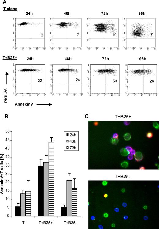 Figure 6. B cell–mediated Th-cell suppression involves induction of T-cell apoptosis. (A) Annexin binding of PKH-26–labeled Th cells cultured alone or with lgB25+ cells + cCD3/IL-2 after different incubation times between 24 and 96 hours, 1 representative experiment of 4 independent experiments shown. (B) Annexin staining of T cells cultured alone or with lgB25+ or smB25− cells at different time points. Mean plus or minus SEM of 6 independent experiments shown. (C) Immunofluorescence microscopy after 24-hour incubation time; 40× magnification. Sixteen adjacent areas in a 4 × 4 array were imaged and stitched together. Images were acquired with respective filters for CD4-APC, CD19-FITC, and annexin-PE; overlay colors: green indicates B cells; blue, T cells; purple, Ax-positive T cells; and yellow, Ax-positive B cells. One representative area with T+ lgB25+ and T+ smB25− is shown.
