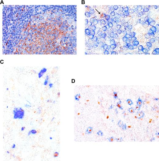 Figure 5. CXCL13 expression in HIV-1+ lymph nodes. Immunohistochemical detection of CXCL13 expression (brown) on paraffin sections and characterization of the positive cells (blue). Slides were viewed with a Zeiss AxioImager M1 microscope for brightfield and fluorescence application (Carl Zeiss, Jena, Germany) using Plan-NEOFLUAR lens at 20×/0.5 and 63×/1.3 oil objective. Images were acquired using AxioCam MRc5 camera (Zeiss) and Axio-Vision (release 4.6) software. Digitalized images were processed with the Module Imaging Plus (Zeiss) and Adobe Photoshop version CS3 Extended software (Adobe Systems, San Jose, CA). Original magnifications, panels A and D, ×80; panels B and C, ×160. (A) In the GC light zone, part of the follicular DC network stained positive for CXCL13. (B) In HIV-1+ tissue, double-positive cells (CXCL13+CD79a+), B cells could be detected. (C) The majority of CXCL13+ cells were found in the T-dependent zone, and double-staining showed that cells were CD68+ macrophages, (D) but that the majority of double-positive cells were CD1a+ immature DCs.
