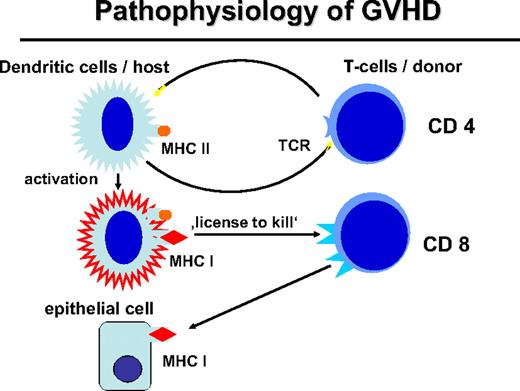 Figure 2. Pathophysiology of GVHD. The interaction of the donor T cell and the host APC leads to the activation of APC and immunogenic presentation of HLA class I–restricted minor histocompatibility antigens (“license to kill”) to activate CD8 cells of the transplantation that can attack mHA on epithelial tissue or also on hematopoietic tissue.